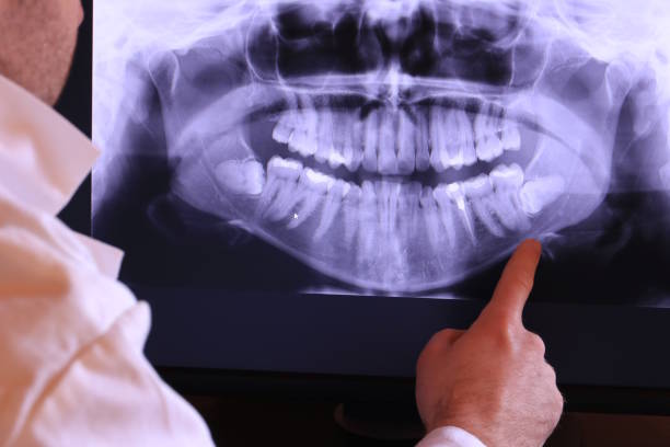 Best Emergency Dental Services for Seniors in Haslet, TX